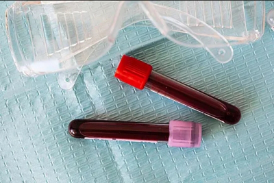 Тест Systems Age от Nature Aging: как быстро стареют наши органы